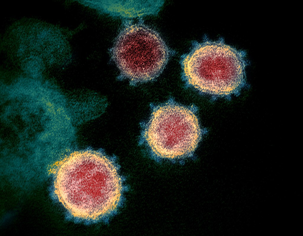 Novel Coronavirus SARS-CoV-2 COVID-19